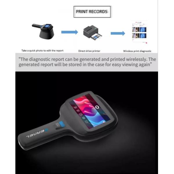 Medical Dermatology Woods Lamp Skin Analysis Veterinary 9000A