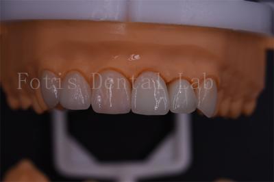 1 Day Digital Crowns Excellent Compatibility With Easy Transmission Via Email Or Software