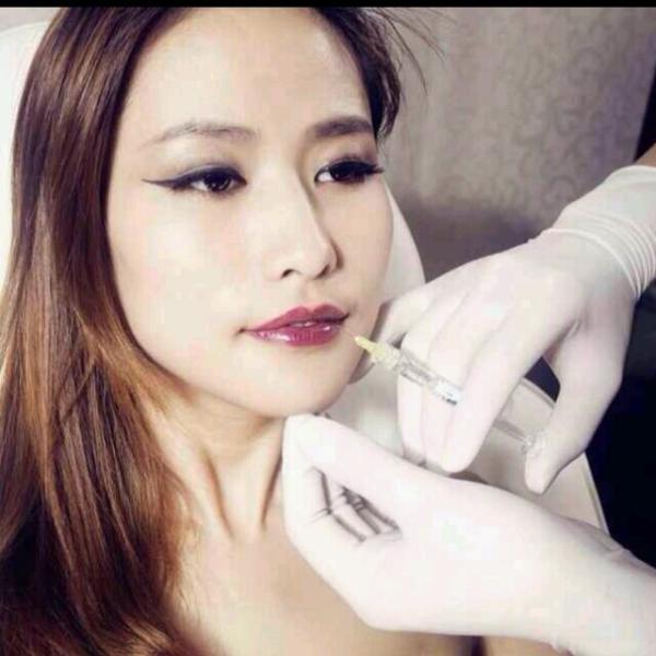 1.0ml2.0ml Super FineLine Natural Hyaluronic Acid Dermal filler For Fine Wrinkle