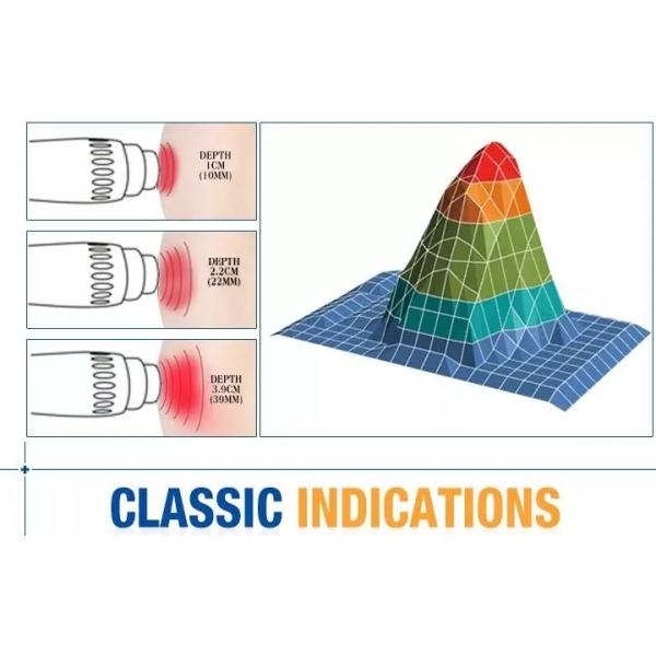 Красота портативной пули машины терапией ударной волны Ed физиотерапии внекорпусная