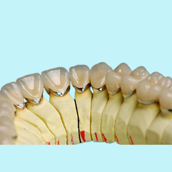Зуб фарфора металла зубоврачебной кроны фарфора сплава титана лаборатории зубоврачебной естественный