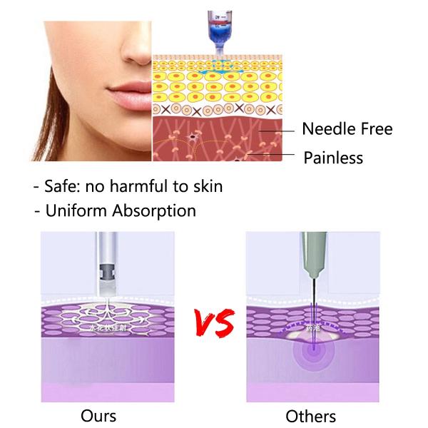 Hyaluronic кисловочный заполнитель губы ручки Ha оружия Mesotherapy ручки 0.3ml