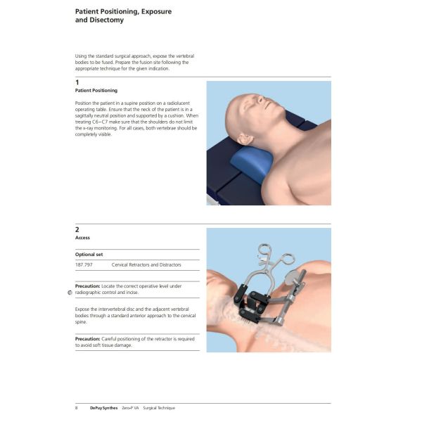 Sterilization 2 Screws Zero Profile Cage Anterior Cervical Cage Stand Alone CE Spinal Surgery