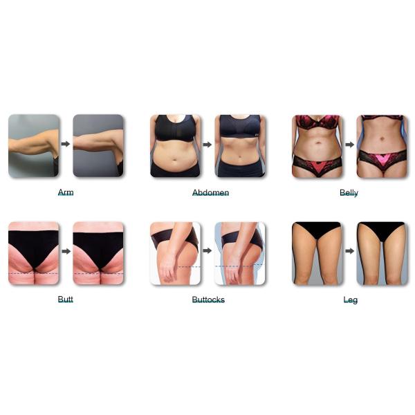 Профилировщик тела потери веса стимулятора мышцы Ems фабрики ваяя уменьшая машину