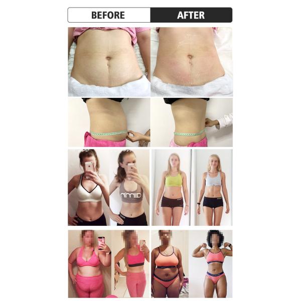 Máquina de congelación de grasa corporal no quirúrgica de enfriamiento por aire Equipo de contorno corporal