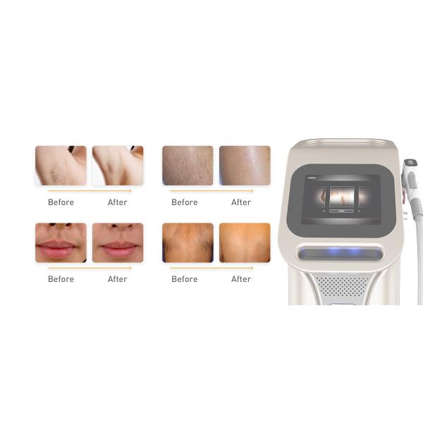 Машины удаления волос лазера системы лазера диода платины 2000W 808Nm льда профессиональные безболезненные постоянные