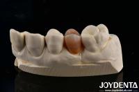 Biocompatible et naturel, couche de zirconie pleine esthétique