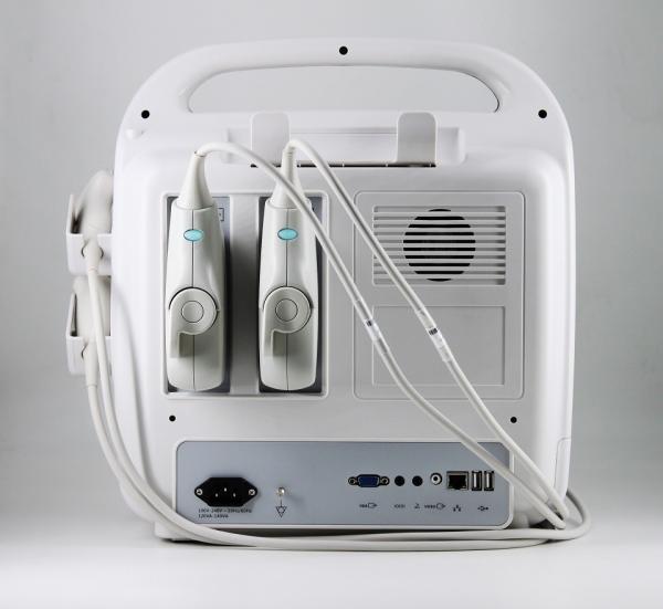 15'' High Definition LCD Monitor Color Doppler Ultrasound Machine Portable 7.5kg