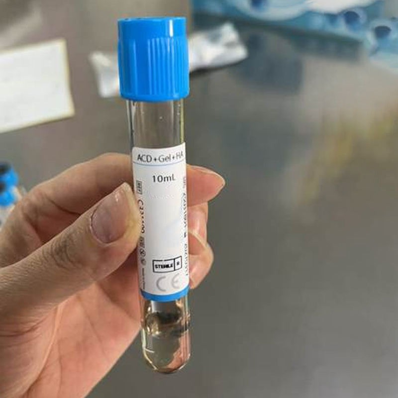 10ml 15ml  ACD Biotin Gel Tube for Laboratory Plasma Separation and Sample Processing  Centrifuge Cosmetology