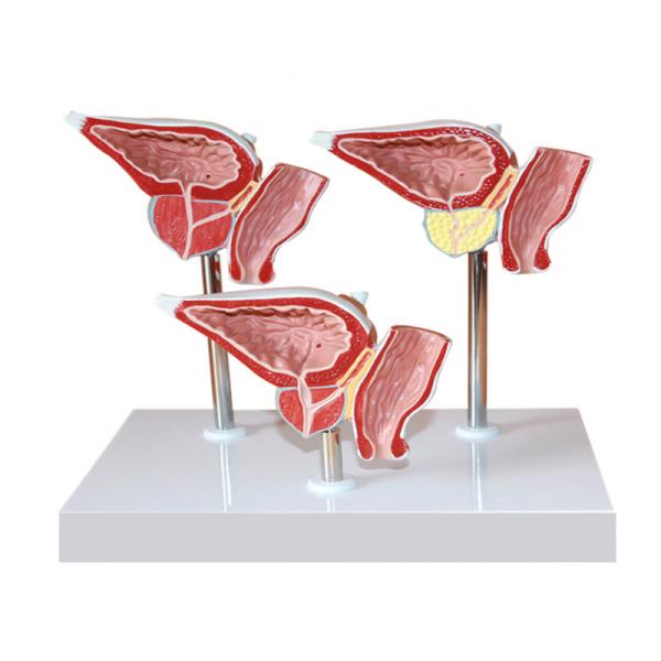 Human Anatomy PVC Simulation Human Pathology Prostate Model For Medical Educational