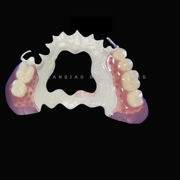 3D Printing Peek Frame Removable Dentures Acrylic Teeth China Dental Lab