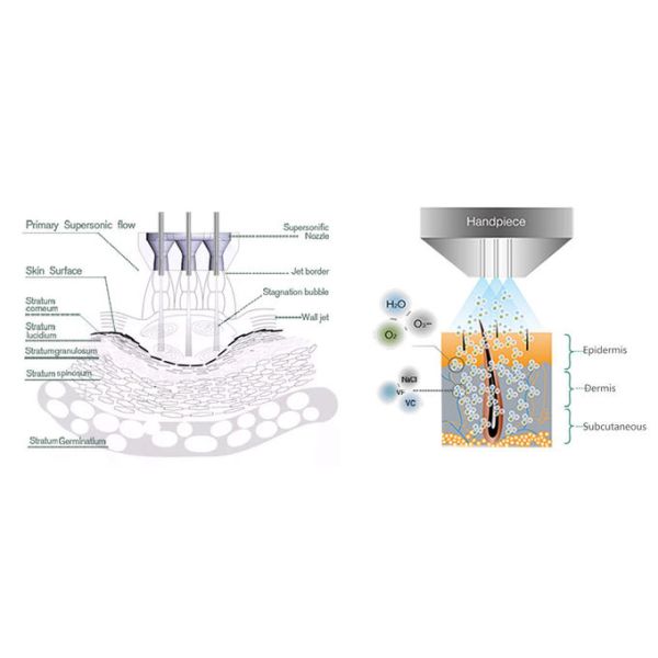 Jet Peel Skin Rejuvenation Machine High Pressure Oxygen Serum Delivery
