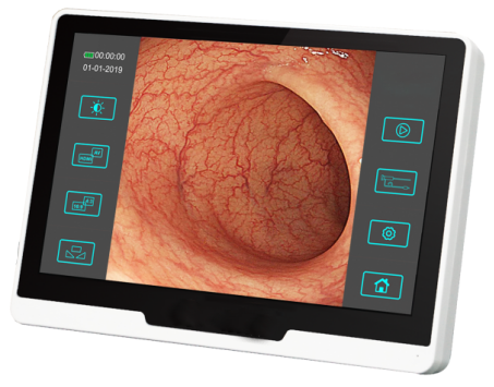 Диаметр 2.8mm медицинского оборудования гибкого Endoscope ветеринарный