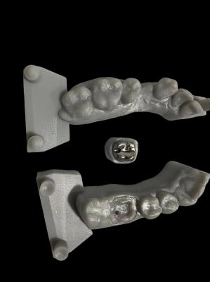Corrosion Resistant Metal Post And Core High Adhesion For Dental Restoration