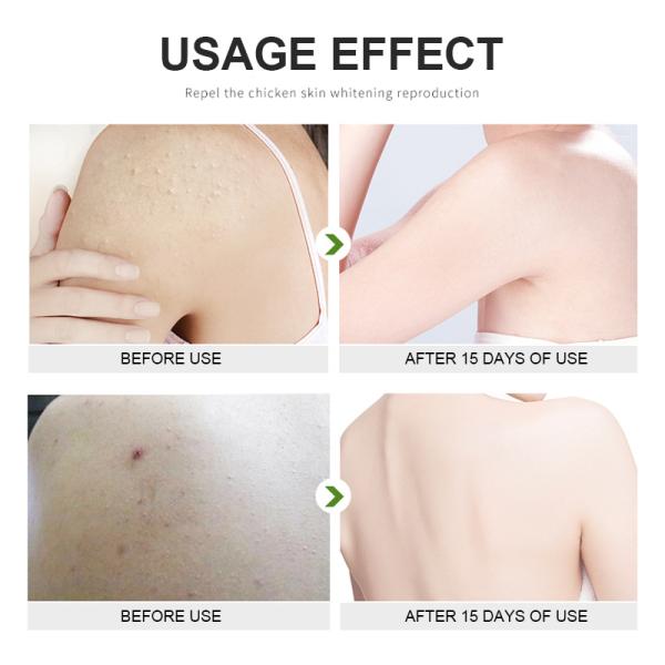 15% Fruit Acid Body Aromatherapy Scrub Lotion Bath Salt Exfoliation And Whitening