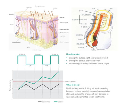 Портативная машина удаления волос SHR личная для системы охлаждения льда обработки женщин