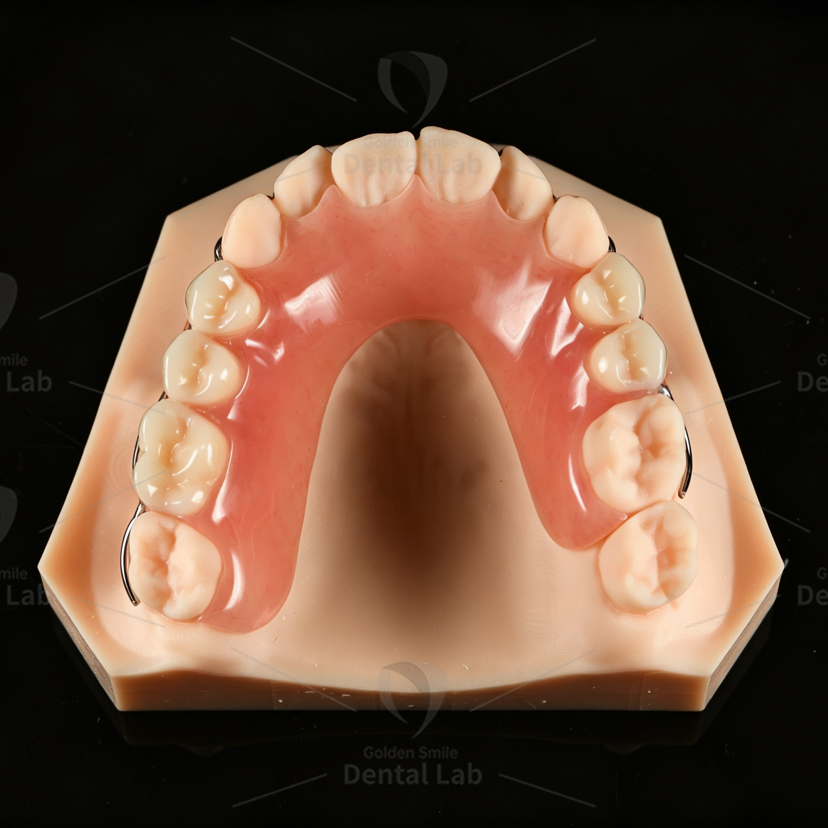 CAD/CAM Removable Partial Denture