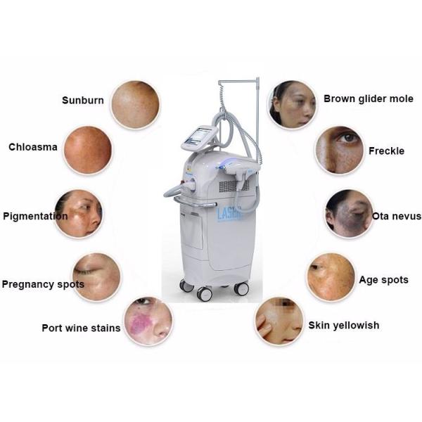 1-7mm Adjustable Spot Diameter Picosecond Laser Tattoo Removal 1064nm 532nm 755nm Nd Yag Laser