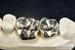 Wax Casting Dental Repair Full Metal Crown For Abrasion Resistant Oral