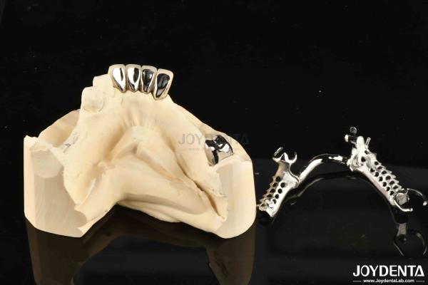 Alloying Metal Dental Framework Removable Wearable For Dental Practitioners