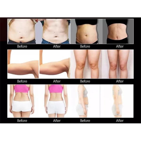 Портативный ваять мышцы тела потери веса Ems машины Emt экрана касания Hi