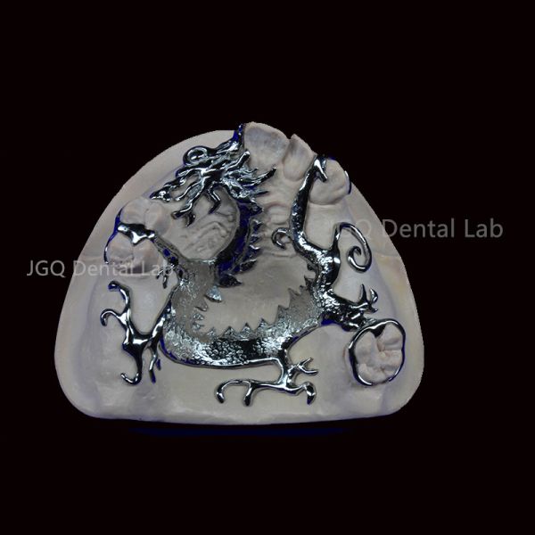 3D Printing Co Cr Alloy Removable Denture Framework Customized for Oral Restoration