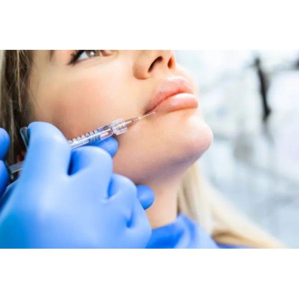 Dermal Lip Fillers JUR KISS Red Lips Injection Filler Customization Hyaluronic Acid Lip Augmentation