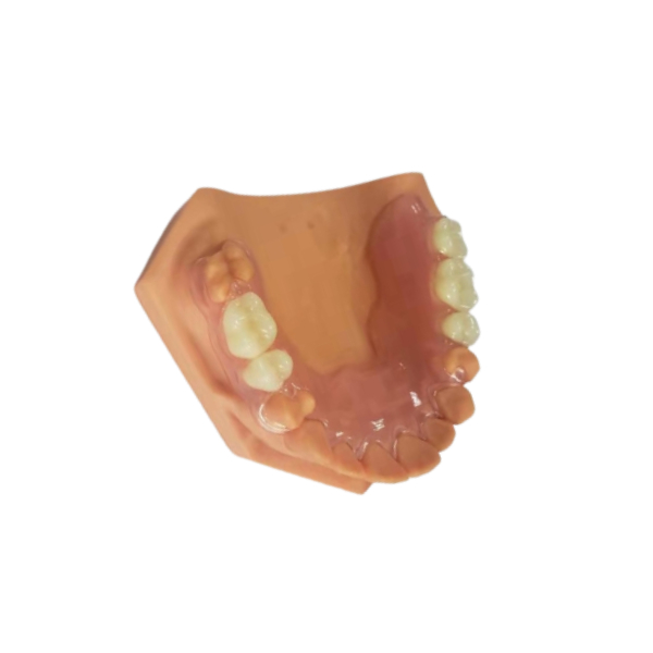 3D напечатало Dentures для зубоврачебных лабораторий основанных на цифровых данных