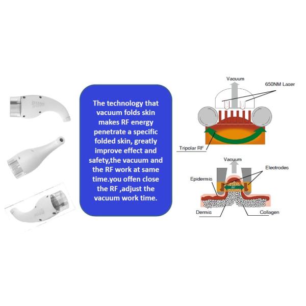 Переносная радиочастотная машина для похудения AU Plugs Ультразвуковая машина для кавитации жира