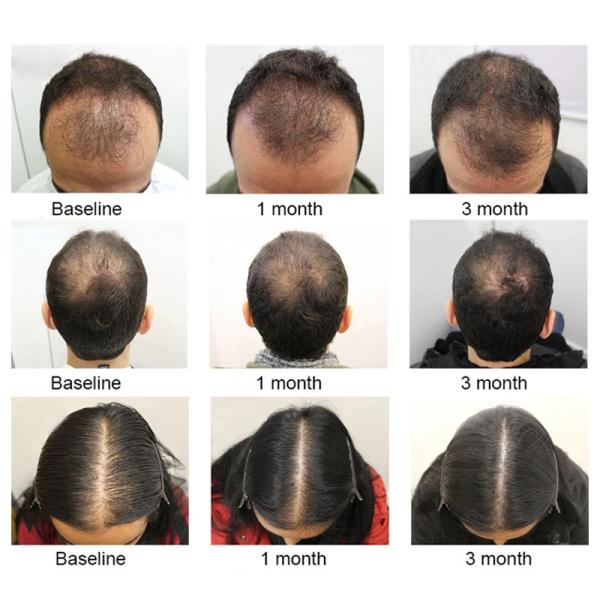 100ml Argan Natural Regrowth Hair Serum Hair Care Products For Hair Loss