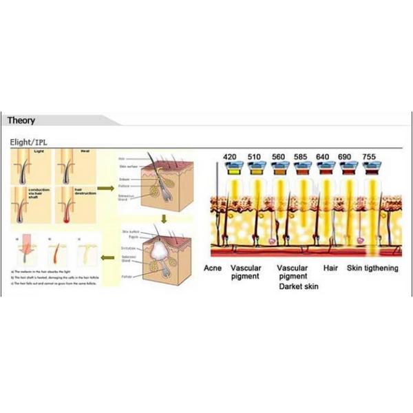 1 - 10 HZ Frequency E- Light IPL RF Machine For Permanent Hair Removal / Skin Rejuvenation