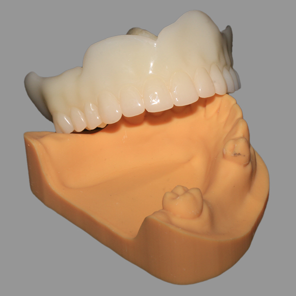 3D Printed Denture Try in Biocompatible A1/A2/A3 for Perfect Fit And Occlusion