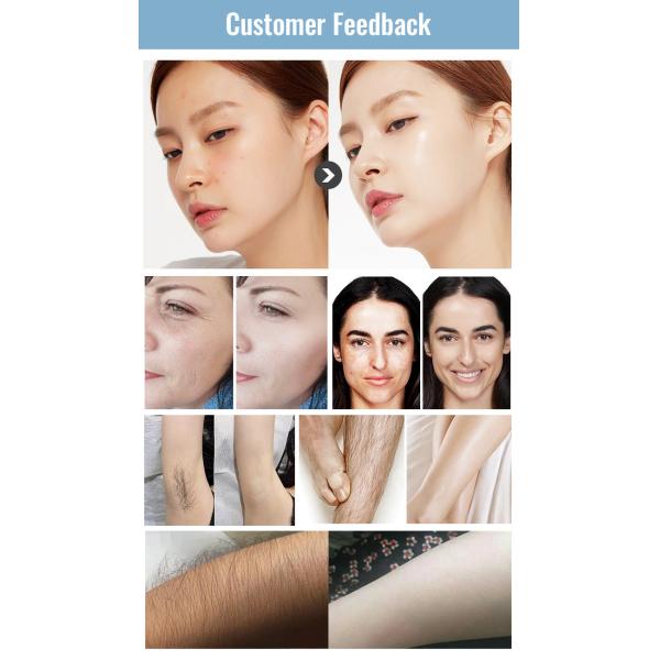 10 barras 808nm Soprano máquina láser de hielo Rejuvenecimiento de la piel y eliminación de pecas