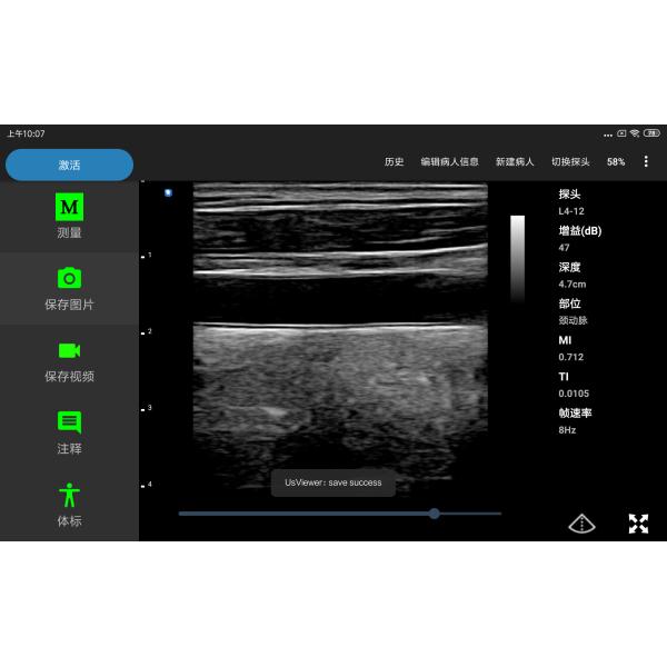CE Diagnosis And Treatment Home Ultrasound Scanner Mobile 8.3MHz