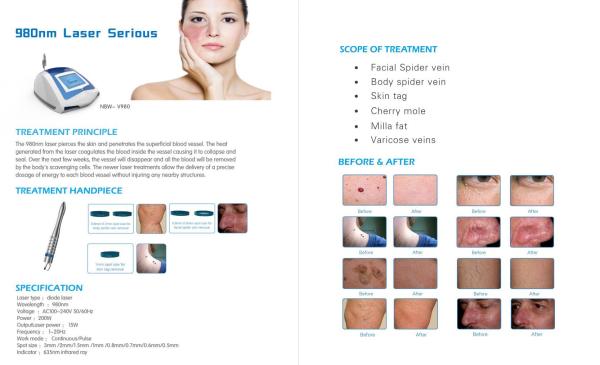 Professional  & good effective 980nm diode laser spider veins removal diode laser price