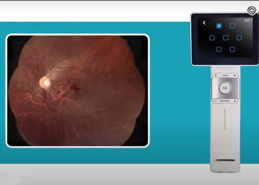 Телемедицины камеры Fundus офтальмоскопа пикселы разрешения 1280 x 960 портативной Handheld доступные видео-