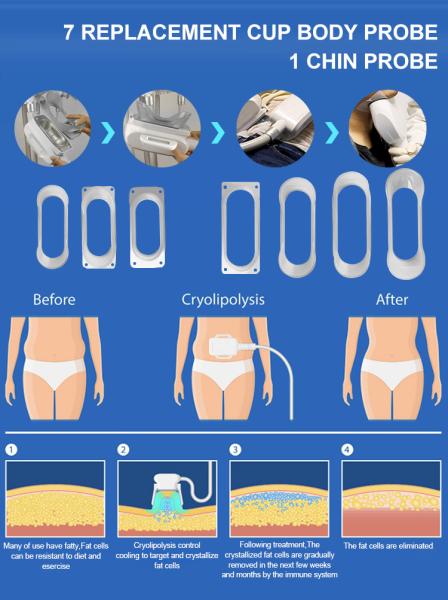 5 In 1 Weight Loss Cryolipolysis Fat Freeze Slimming Machine