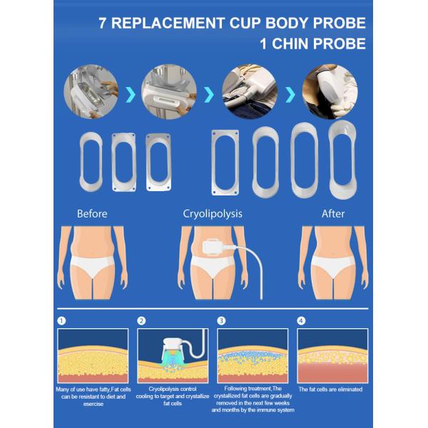 Кавитация 4 Cryo Lipolaser RF машины Cryolipolysis в 1 жирной системе замораживателя для уменьшения тела
