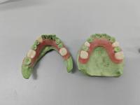 Resina de base de dentadura invisível para produção rápida e restauração parcialmente dentada