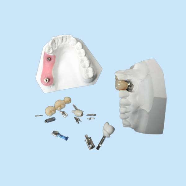 Высокая крона зубного имплантата Zirconia стойкости для зубоврачебного восстановления