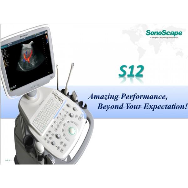 Fetal Imaging SonoScape Ultrasound Machine Portable Ultrasound Trolley S12