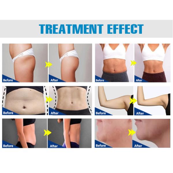 Muscle Stimulator Weight Loss Slim Beauty Machine Body Muscle Sculpt