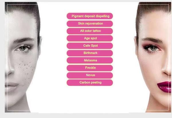 Minimal Recovery Q Switch ND Yag Laser System For Hyperpigmentation / Birthmark Removal