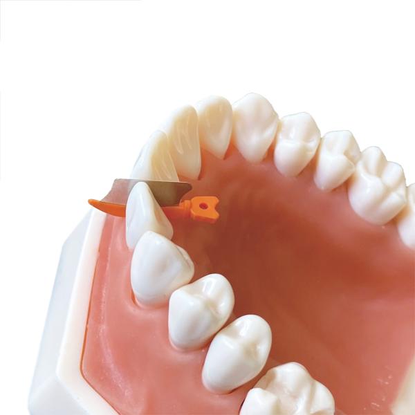 Dental Sectional Matrix System Wedge Guards M3 3.0