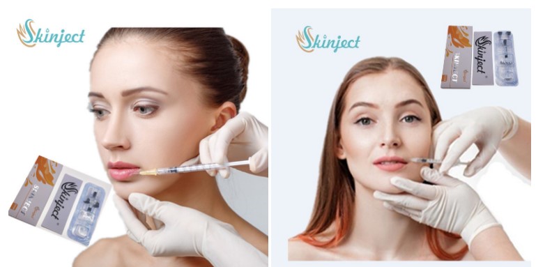 Заполнитель губ вводимого дермального заполнителя Skinject кисловочный Hyaluronic