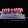 Customized Implant Teeth Bridge Implanting Guide Look Like Natural Teeth Restore Oral Health, Function and Appearance