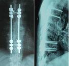 Filme seco afiado de X Ray de Digitas radiológico para Fujifilm Instax 2000