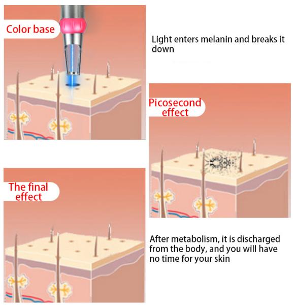 Máquina comutada Q médica do laser do Nd Yag, máquina da remoção da tatuagem do laser da beleza