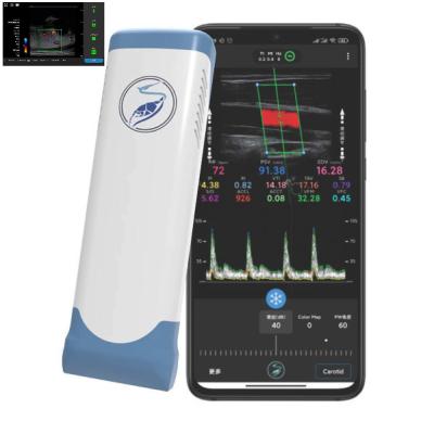 256 Scan Lines Ipad Ultrasound Transducer Wireless Ultrasound Probe For PICC