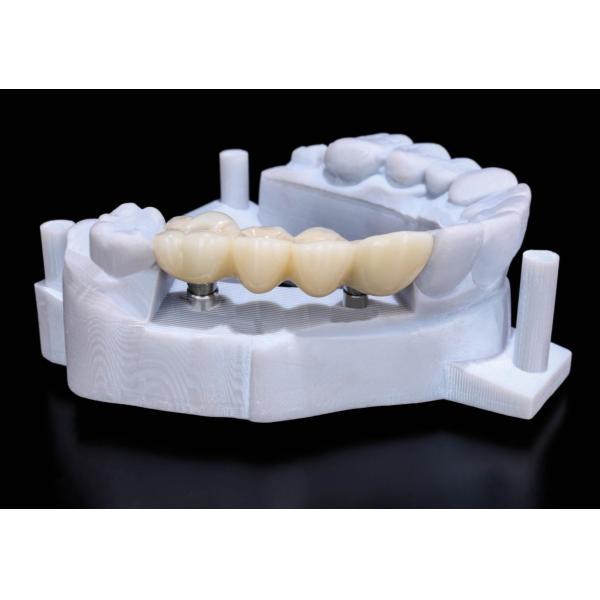 Autoclave Sterilizable 3mm×2mm Titanium Implant Bars Restoration Dental Implant Bar